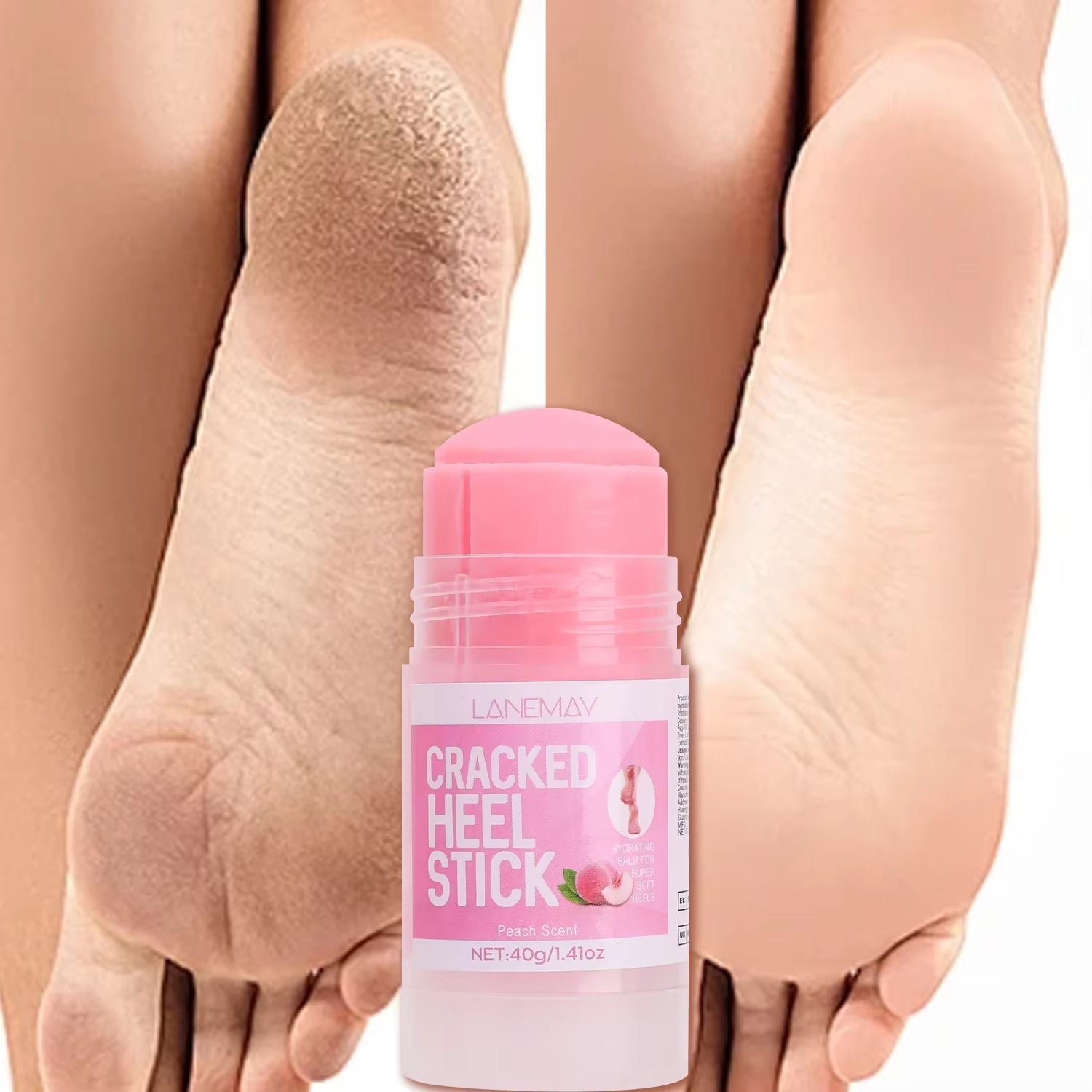 40G Ultra-Hydrating Foot Cream Softening Dry Cracked Feet Daily Foot Care Solution Feet Cream Stick Repairing Moisturizing Tool